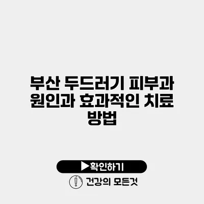 부산 두드러기 피부과 원인과 효과적인 치료 방법